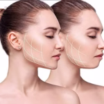 Dispozitiv de Tonifiere Faciala, Flippy, din Silicon, Corectare Mandibula/Maxilar, Roz - imagine 4
