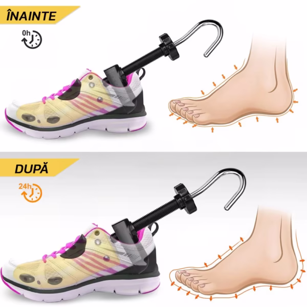 Set 2 Sanuri/Calapoade Reglabilile, Flippy, pentru Alungit si Largit Pantofi, Geanta si Incaltator Incluse, Universale, Unisex, din ABS Premium, Arc, Marime 35 - 42, Galben/Negru - imagine 1